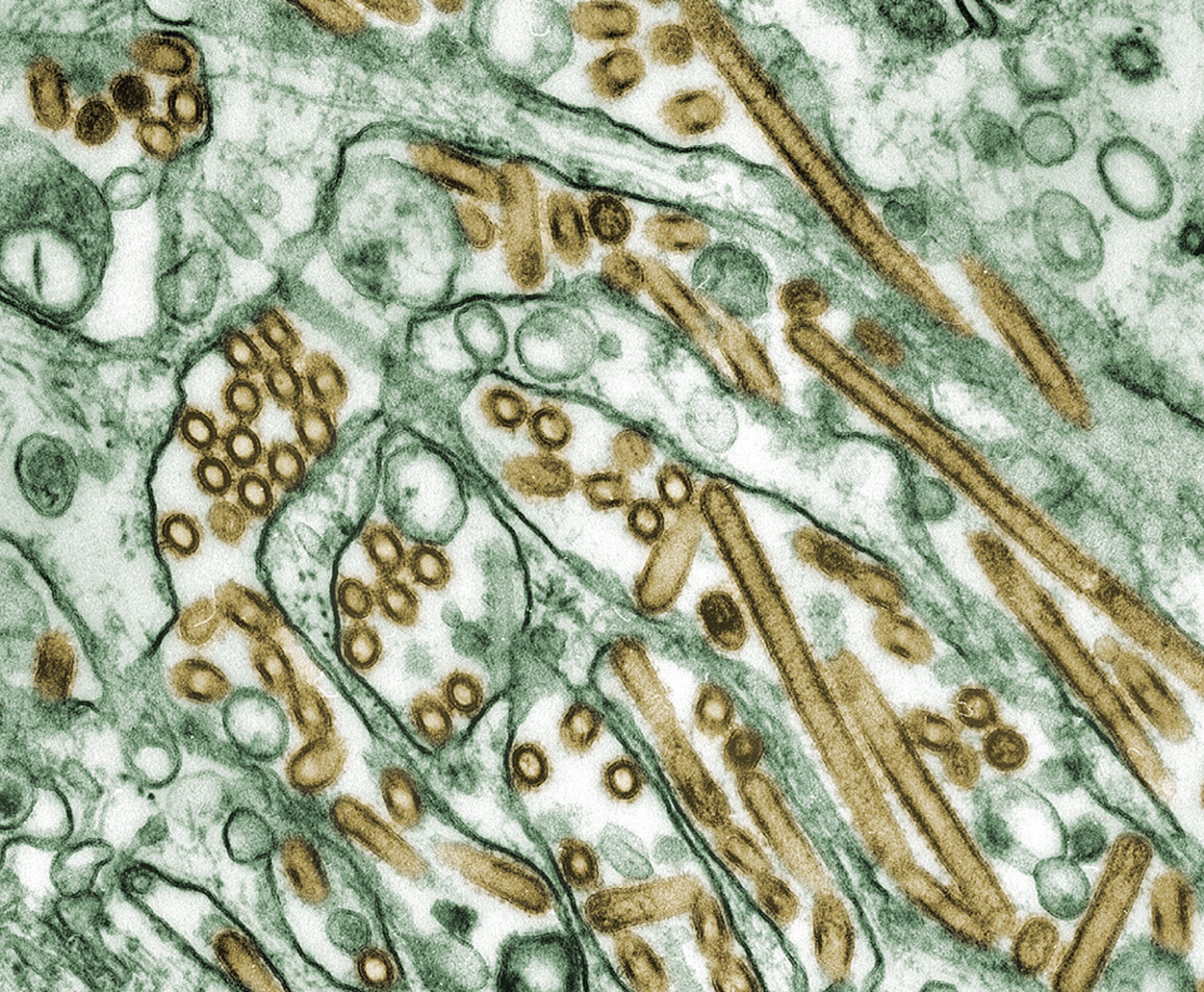 Colorized transmission electron micrograph of Avian influenza A H5N1 viruses